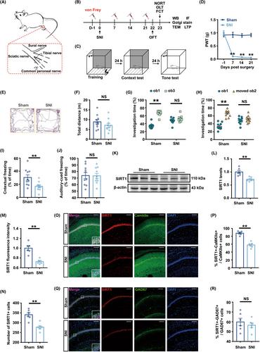 Hippocampal synaptic plasticity injury mediated by SIRT1 downregulation is involved in chronic pain-related cognitive dysfunction