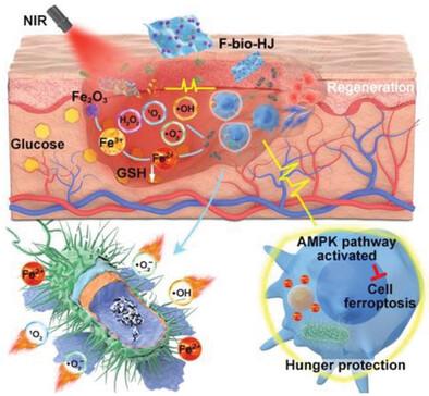 Engineered Bio-Heterojunction Confers Extra- and Intracellular Bacterial Ferroptosis and Hunger-Triggered Cell Protection for Diabetic Wound Repair