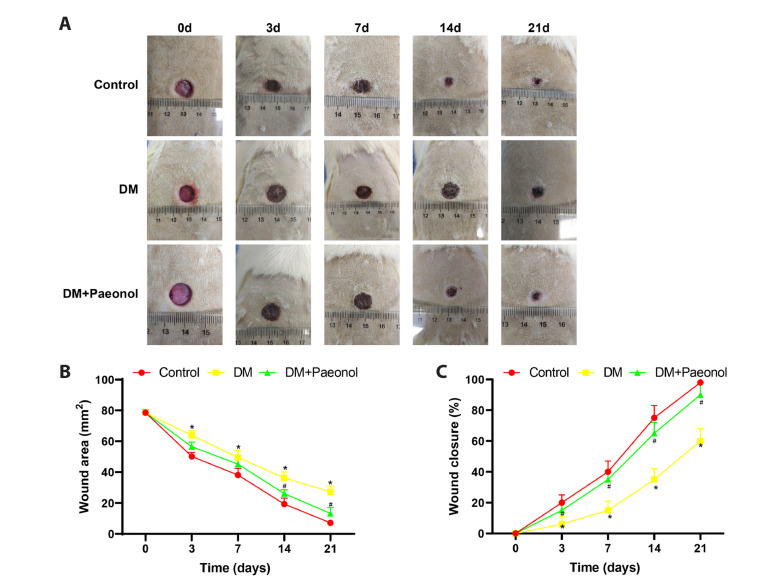 Paeonol accelerates skin wound healing by regulating macrophage polarization and inflammation in diabetic rats.