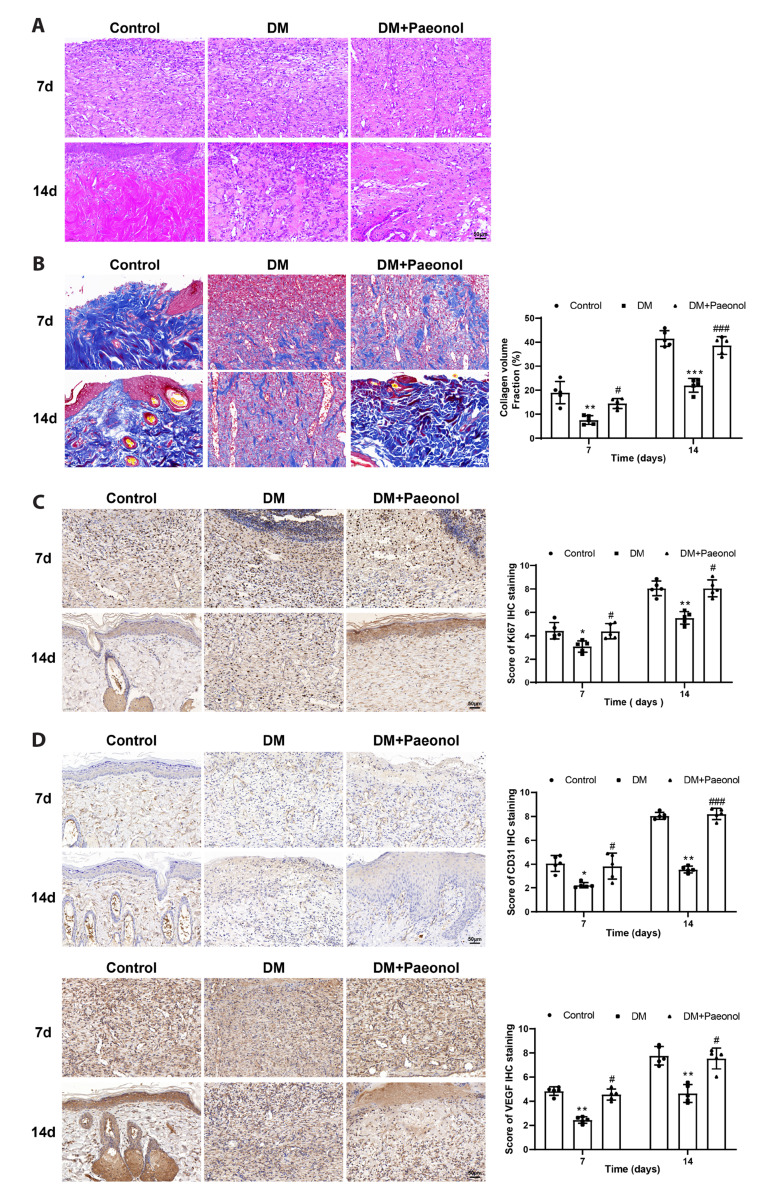 Paeonol accelerates skin wound healing by regulating macrophage polarization and inflammation in diabetic rats.