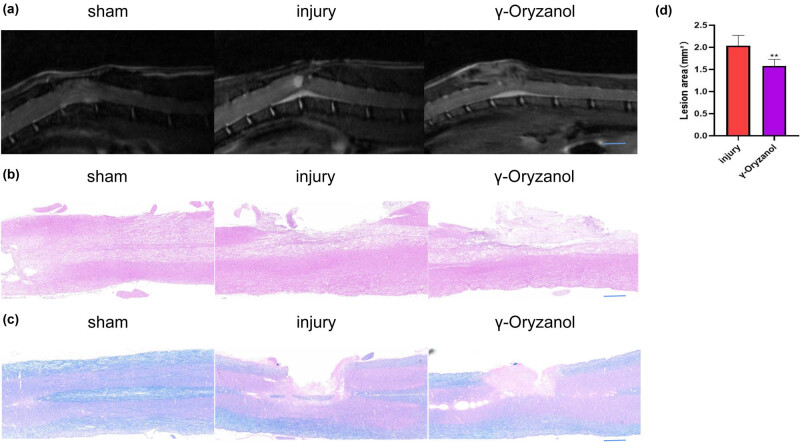 Effects of γ-oryzanol on motor function in a spinal cord injury model.