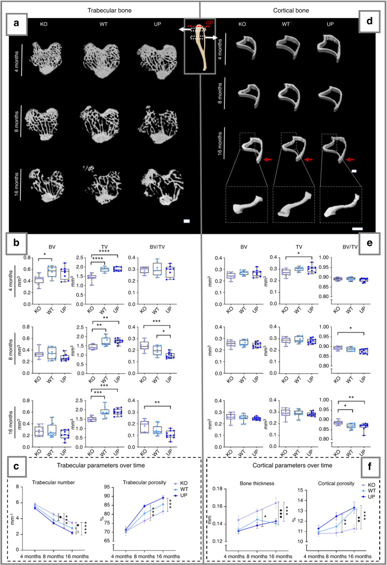 Osteomodulin downregulation is associated with osteoarthritis development.