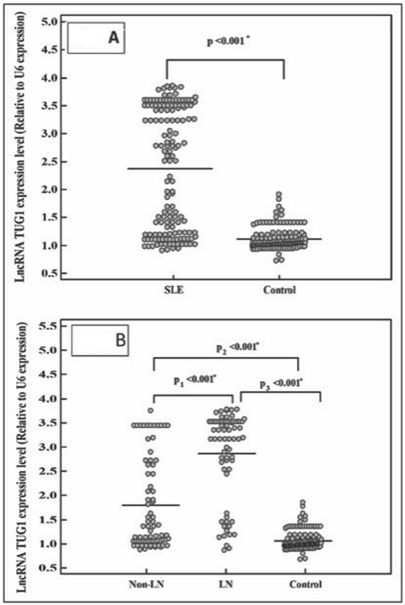 Long Non-Coding RNA TUG1 Gene Polymorphism and TUG1 Expression Level as Molecular Biomarkers of Systemic Lupus Erythematosus and Lupus Nephritis.