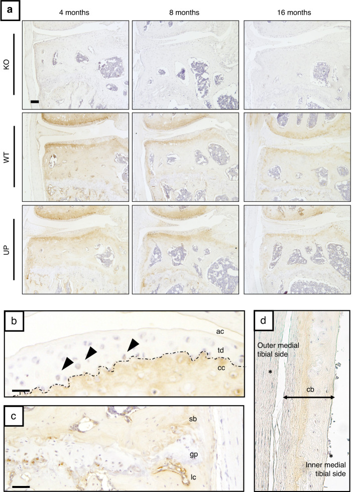 Osteomodulin downregulation is associated with osteoarthritis development.