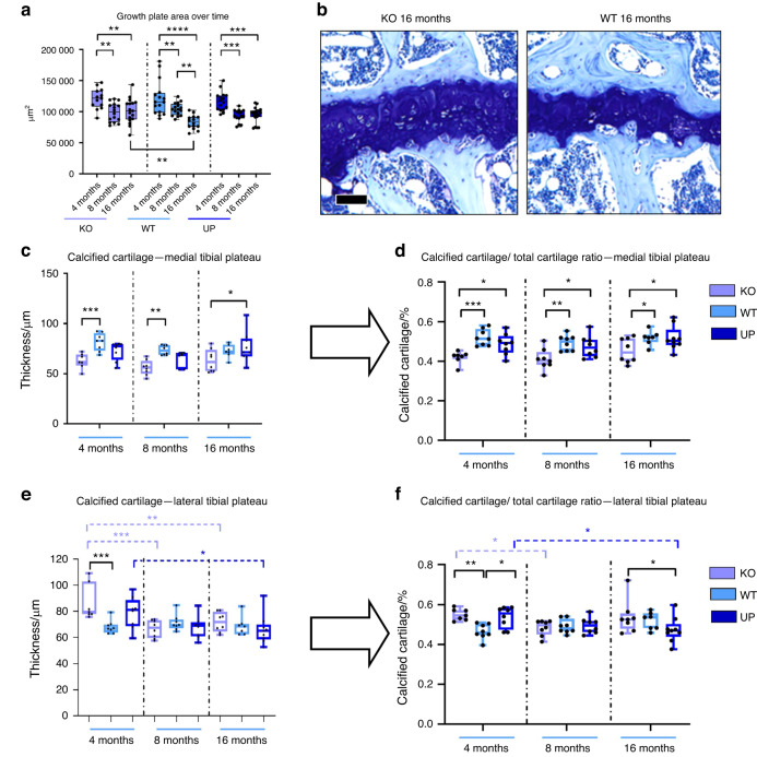 Osteomodulin downregulation is associated with osteoarthritis development.