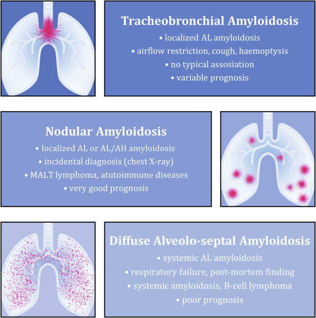 A unique case of AH-dominant type nodular pulmonary amyloidosis presenting as a spontaneous pneumothorax: a case report and review of the literature.