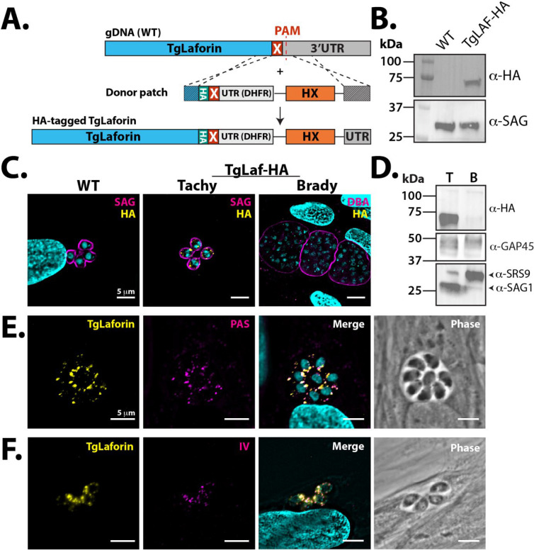 TgLaforin, a glucan phosphatase, reveals the dynamic role of storage polysaccharides in <i>Toxoplasma gondii</i> tachyzoites and bradyzoites.