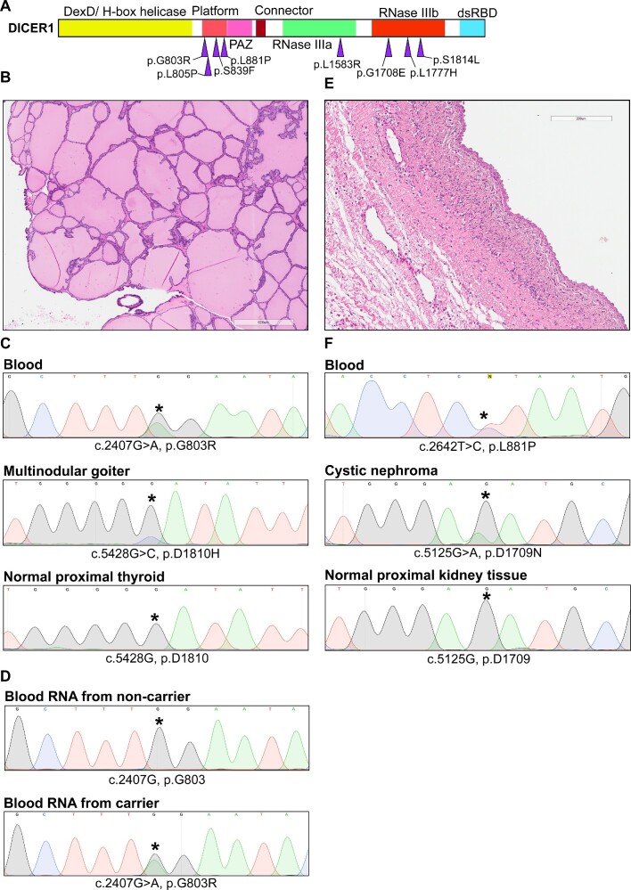 DICER1 platform domain missense variants inhibit miRNA biogenesis and lead to tumor susceptibility.