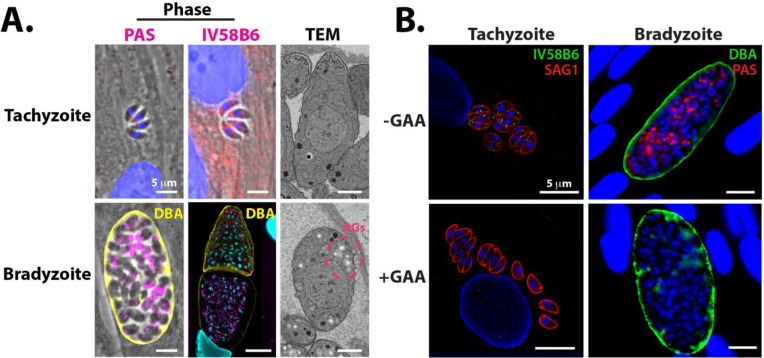 TgLaforin, a glucan phosphatase, reveals the dynamic role of storage polysaccharides in <i>Toxoplasma gondii</i> tachyzoites and bradyzoites.