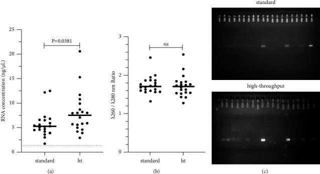 Efficiency of Automated Viral RNA Purification for Pediatric Studies of Dengue and Zika in Hyperendemic Areas.