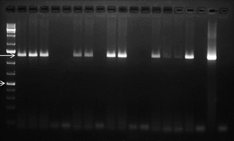 Microsporidia in HIV-Positive and HIV-Negative Pediatric Patients with Diarrhea at a Tertiary Care Hospital.