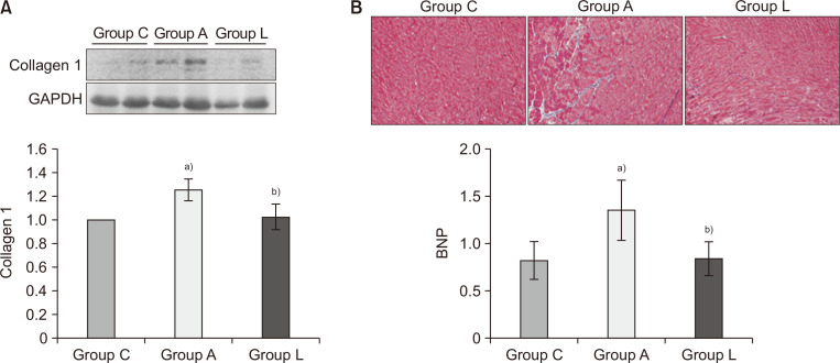 Losartan Reduces Remodeling and Apoptosis in an Adriamycin-Induced Cardiomyopathy Rat Model.