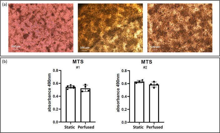 Human gut epithelium features recapitulated in MINERVA 2.0 millifluidic organ-on-a-chip device.