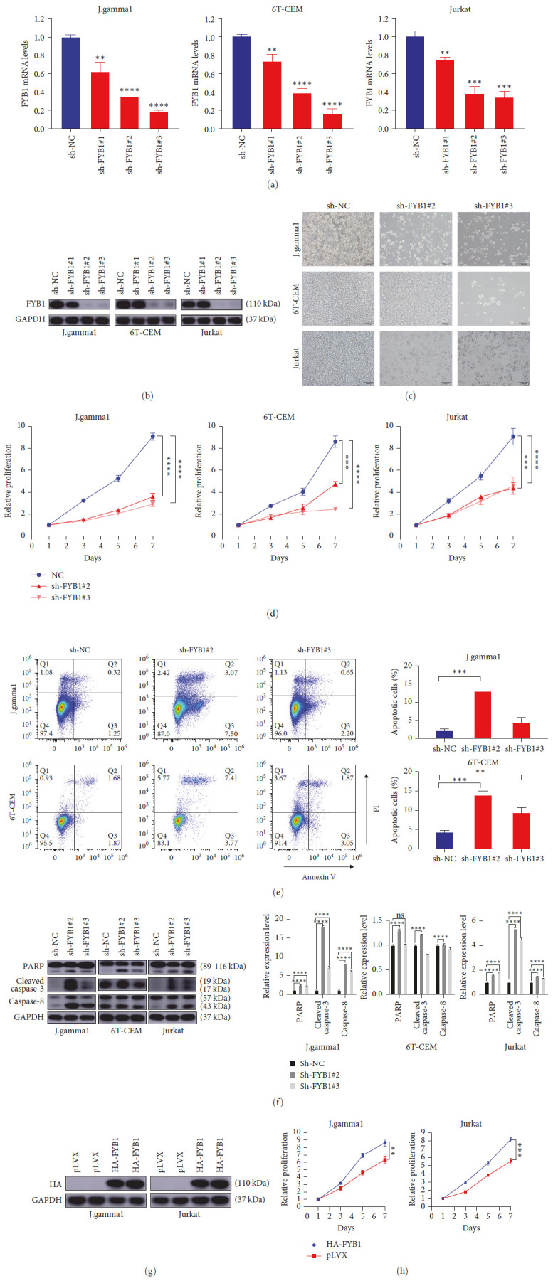 Super Enhancer Regulatory Gene FYB1 Promotes the Progression of T Cell Acute Lymphoblastic Leukemia by Activating IGLL1.