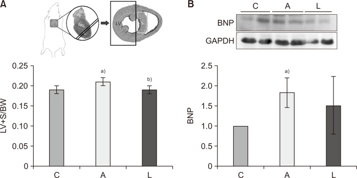 Losartan Reduces Remodeling and Apoptosis in an Adriamycin-Induced Cardiomyopathy Rat Model.