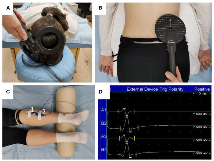 Corticospinal excitability after 5-day Dry Immersion in women.