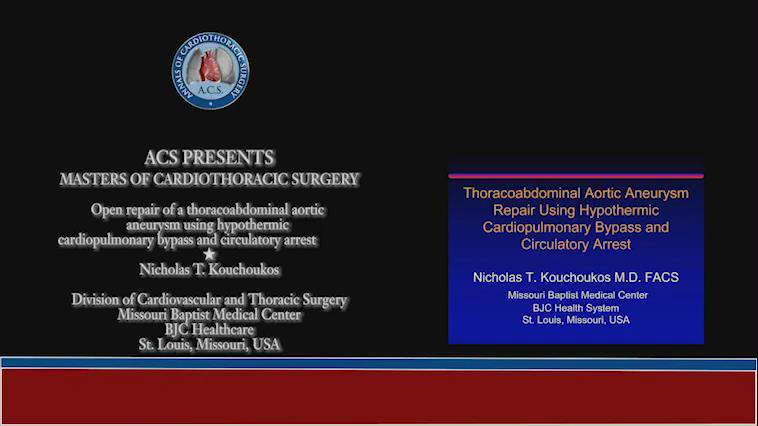 Open repair of a thoracoabdominal aortic aneurysm using hypothermic cardiopulmonary bypass and circulatory arrest.