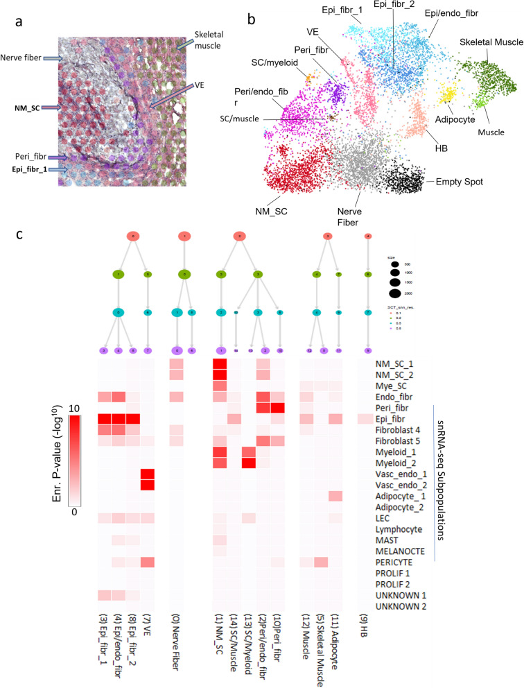 Integration of single-nuclei RNA-sequencing, spatial transcriptomics and histochemistry defines the complex microenvironment of NF1-associated plexiform neurofibromas.