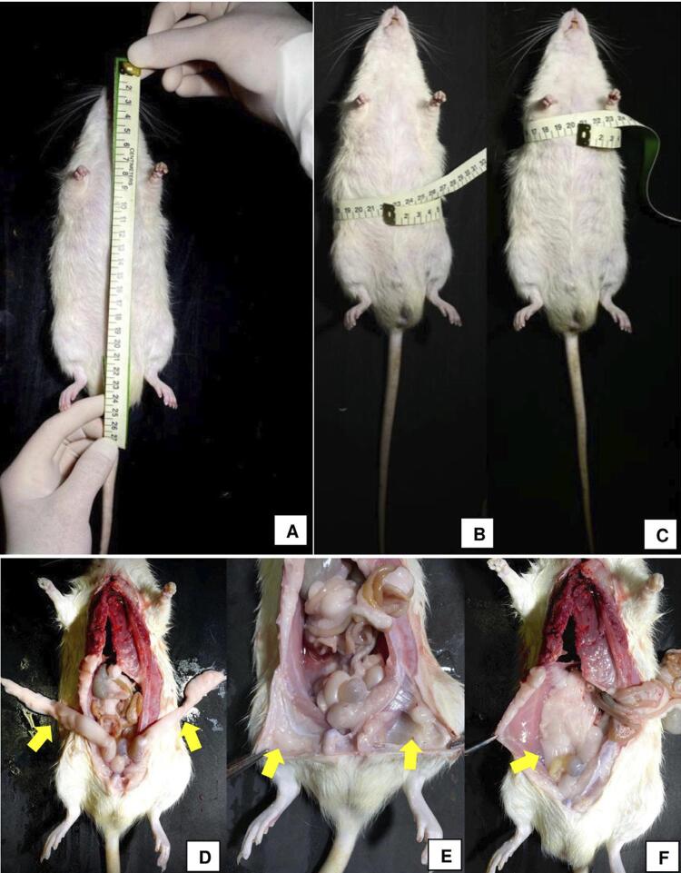 Obesity influences the development of bisphosphonate-induced osteonecrosis in Wistar rats.