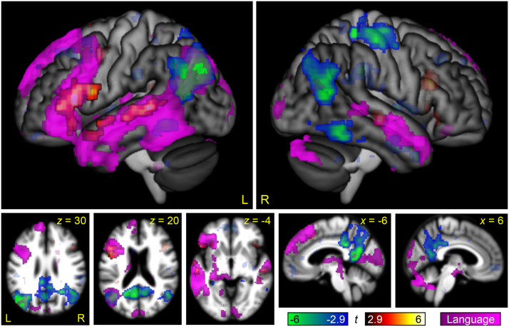 Modality-Specificity of the Neural Correlates of Linguistic and Non-Linguistic Demand.