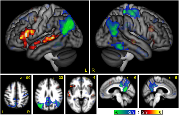 Modality-Specificity of the Neural Correlates of Linguistic and Non-Linguistic Demand.