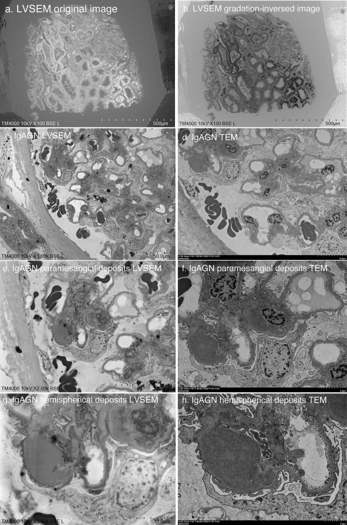 Direct observation of epoxy resin blocks for renal biopsy by low-vacuum scanning electron microscopy.