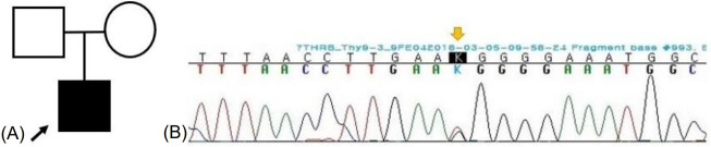 A novel variant of THRβ and its 4-year clinical course in a Korean boy with resistance to thyroid hormone.