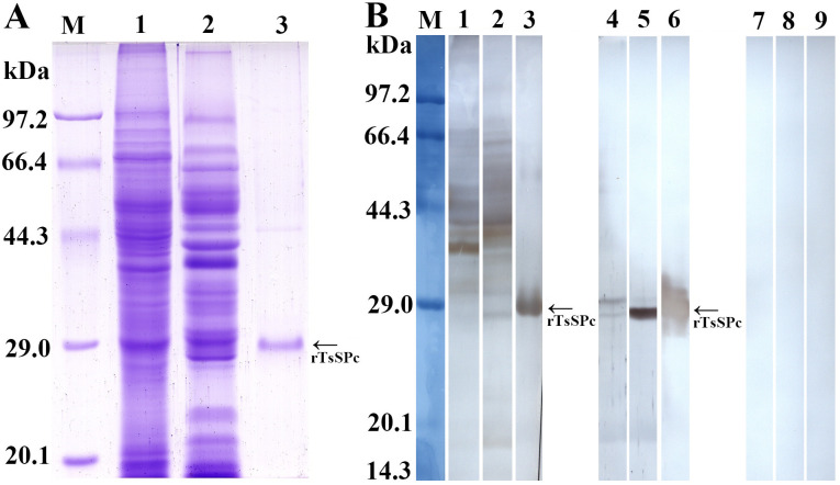 Molecular characterization of a novel serine proteinase from Trichinella spiralis and its participation in larval invasion of gut epithelium.