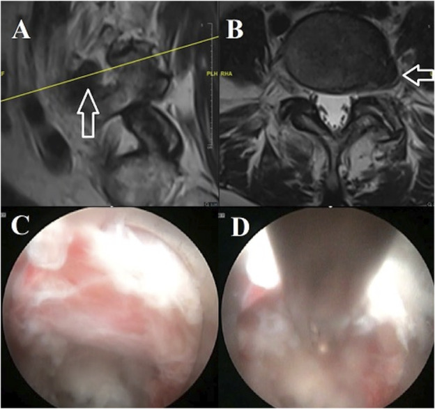 Development of an Endoscopic Spine Surgery Program: Overview and Basic Considerations for Implementation.