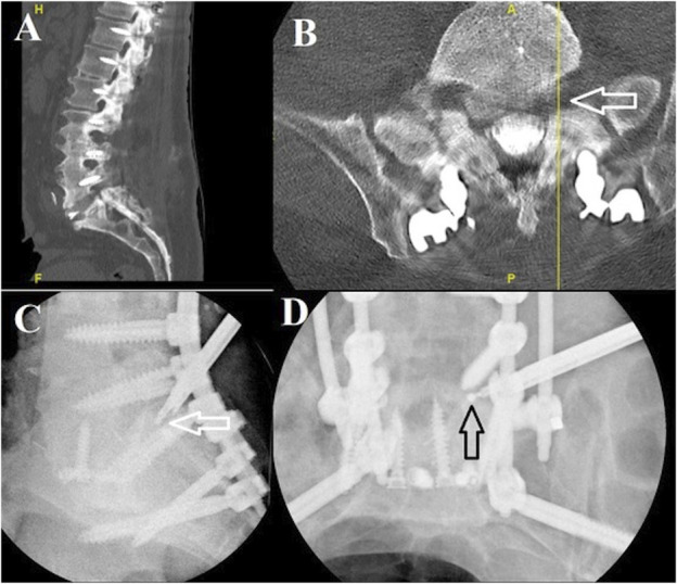 Development of an Endoscopic Spine Surgery Program: Overview and Basic Considerations for Implementation.