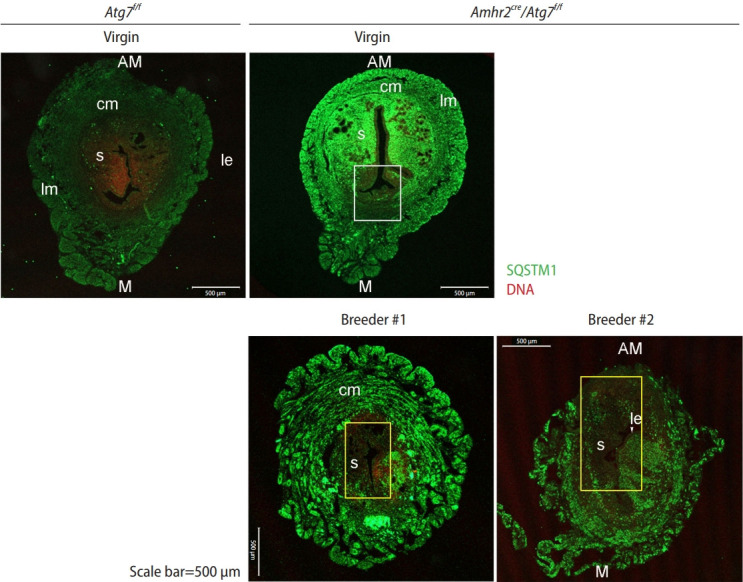 Repopulation of autophagy-deficient stromal cells with autophagy-intact cells after repeated breeding in uterine mesenchyme-specific Atg7 knockout mice.