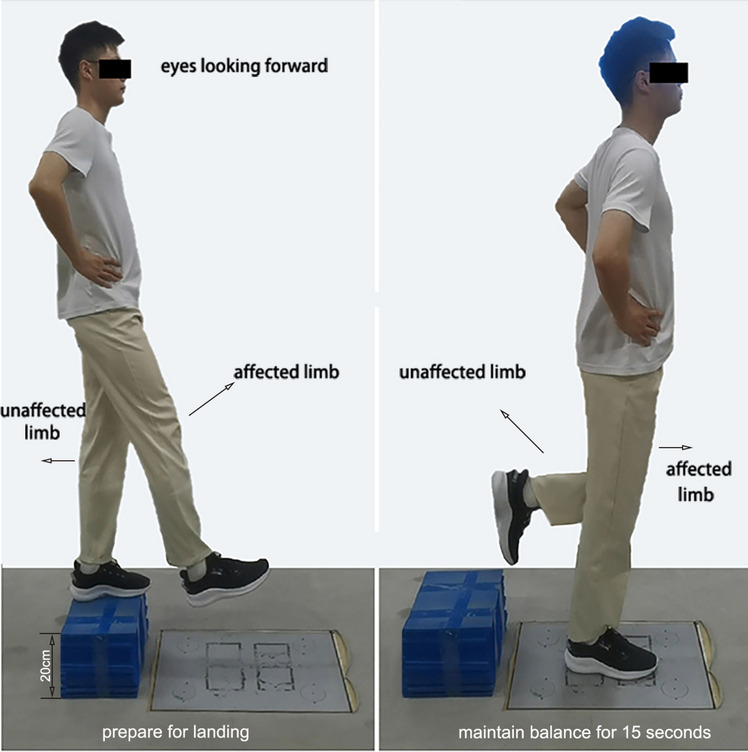 Effects of textured insoles and elastic braces on dynamic stability in patients with functional ankle instability.