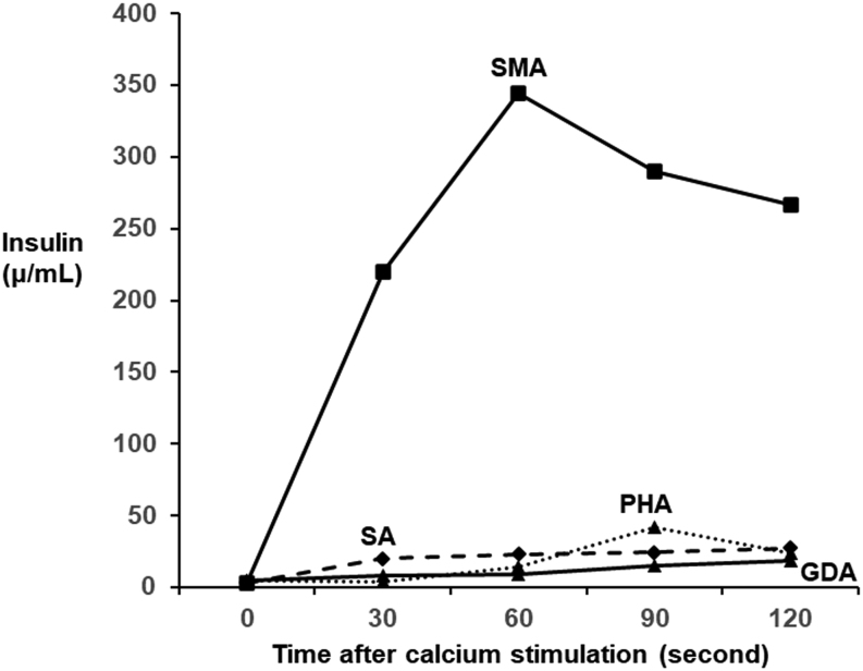 Continuous glucose monitoring in a patient with insulinoma presenting with unawareness of postprandial hypoglycemia.