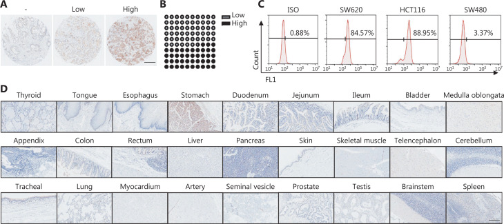 The inducible secreting TLR5 agonist, CBLB502, enhances the anti-tumor activity of CAR133-NK92 cells in colorectal cancer.