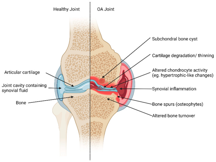 Collagen Hydrolysates: A Source of Bioactive Peptides Derived from Food Sources for the Treatment of Osteoarthritis.