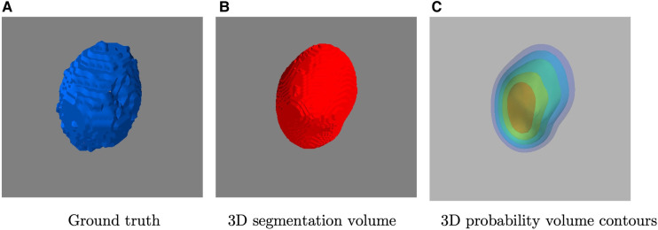 From coarse to fine: a deep 3D probability volume contours framework for tumour segmentation and dose painting in PET images.