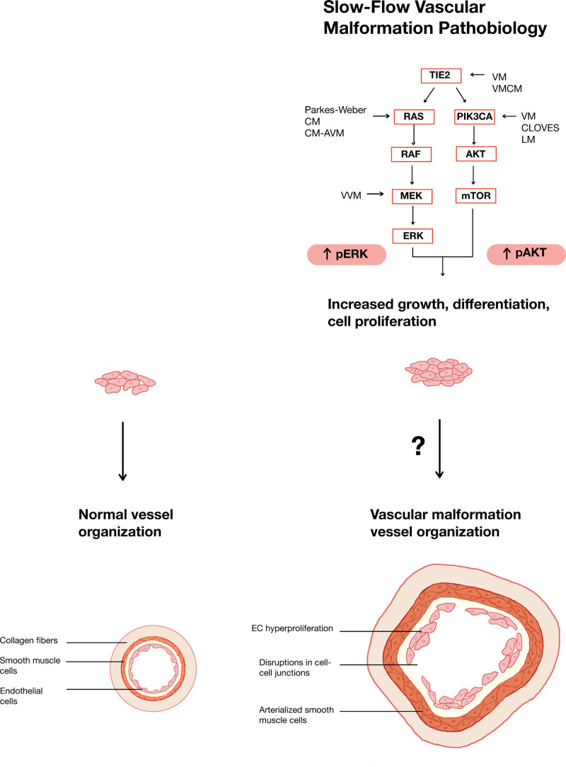 Pathophysiology of Slow-Flow Vascular Malformations: Current Understanding and Unanswered Questions.