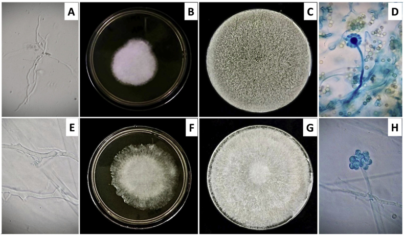 Peritoneal dialysis-associated peritonitis from pauci-septated mold: Life-threatening but curable