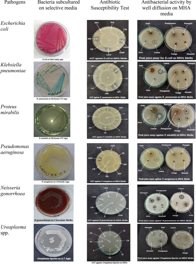 Antibacterial Activity of Selected Fruit Juices against Multidrug-Resistant Bacterial Pathogens Involved in Urinary Tract and Sexually Transmitted Infections among Tribal Women in Madhya Pradesh, India.