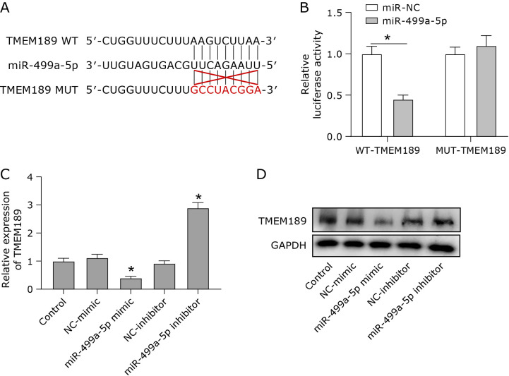 TMEM189 as a target gene of MiR-499a-5p regulates breast cancer progression through the ferroptosis pathway.