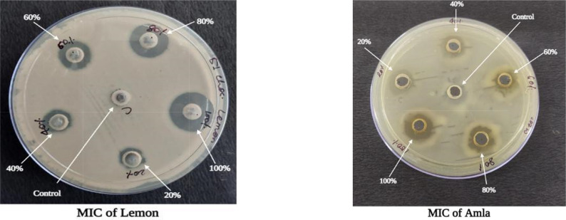 Antibacterial Activity of Selected Fruit Juices against Multidrug-Resistant Bacterial Pathogens Involved in Urinary Tract and Sexually Transmitted Infections among Tribal Women in Madhya Pradesh, India.