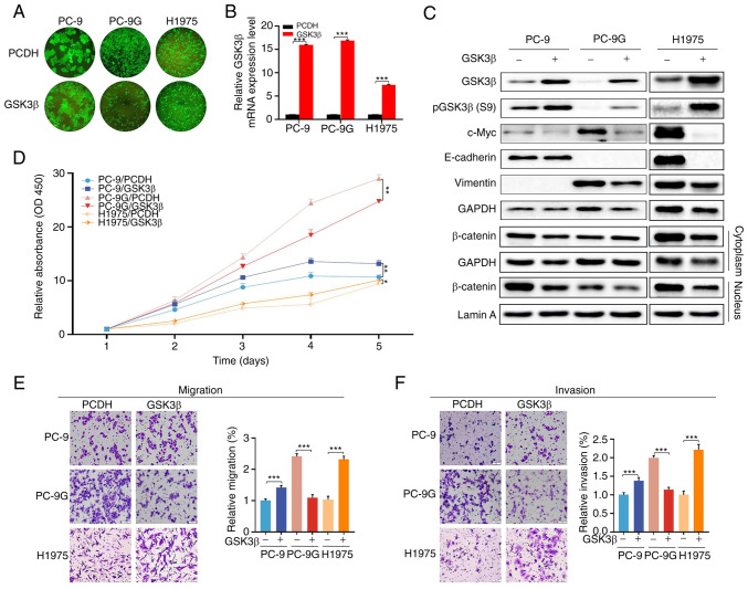 Biphasic function of GSK3β in gefitinib‑resistant NSCLC with or without EGFR mutations.