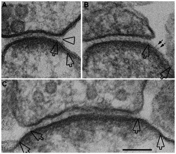 Modification of the synaptic cleft under excitatory conditions.