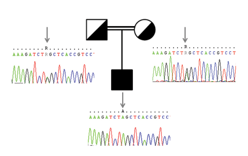 Molecular Evaluation of Joubert Syndrome and Hearing Impairment in a Patient with Ataxic Cerebral Palsy.