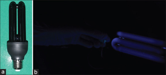 Comparative evaluation and influence of various staining agents on color stability and fluorescence of different esthetic orthodontic wires: An <i>in vitro</i> study.