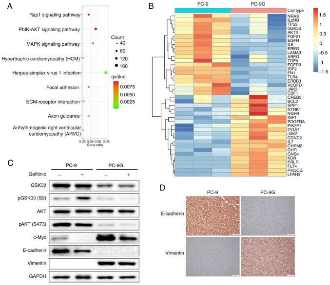 Biphasic function of GSK3β in gefitinib‑resistant NSCLC with or without EGFR mutations.