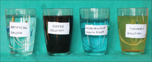 Comparative evaluation and influence of various staining agents on color stability and fluorescence of different esthetic orthodontic wires: An <i>in vitro</i> study.