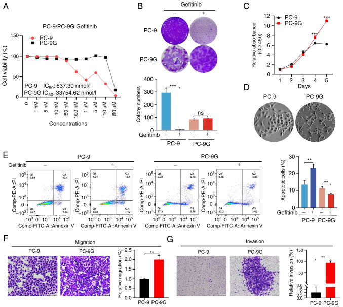 Biphasic function of GSK3β in gefitinib‑resistant NSCLC with or without EGFR mutations.