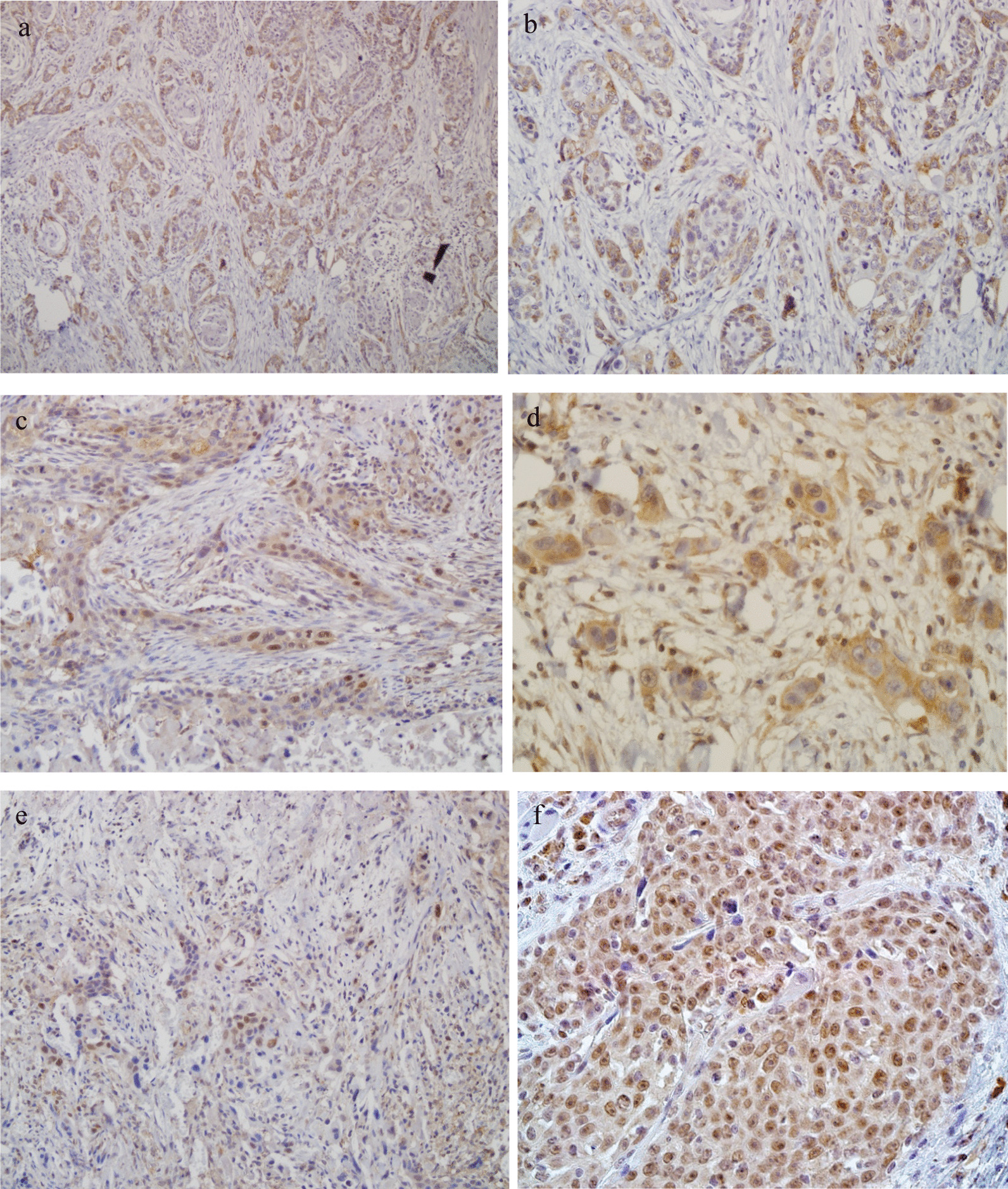 Human parvovirus B19 infection in malignant and benign tissue specimens of different head and neck anatomical subsites.