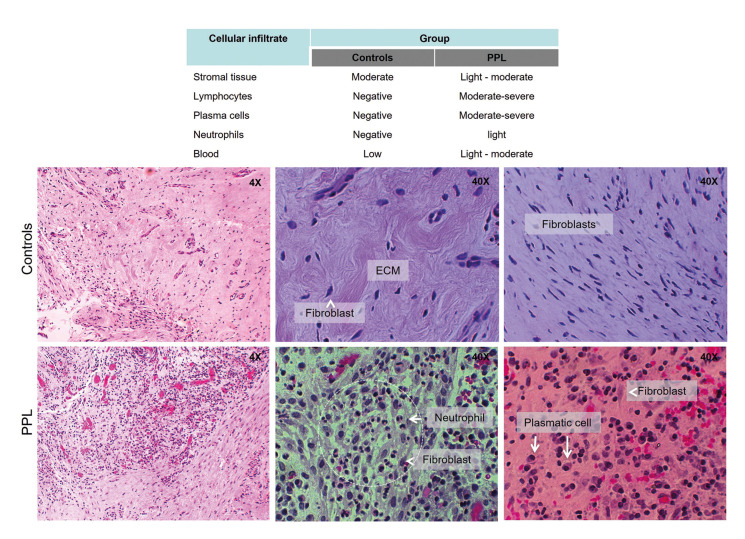 Reduction of NrF2 as coadjuvant during the development of persistent periapical lesions.